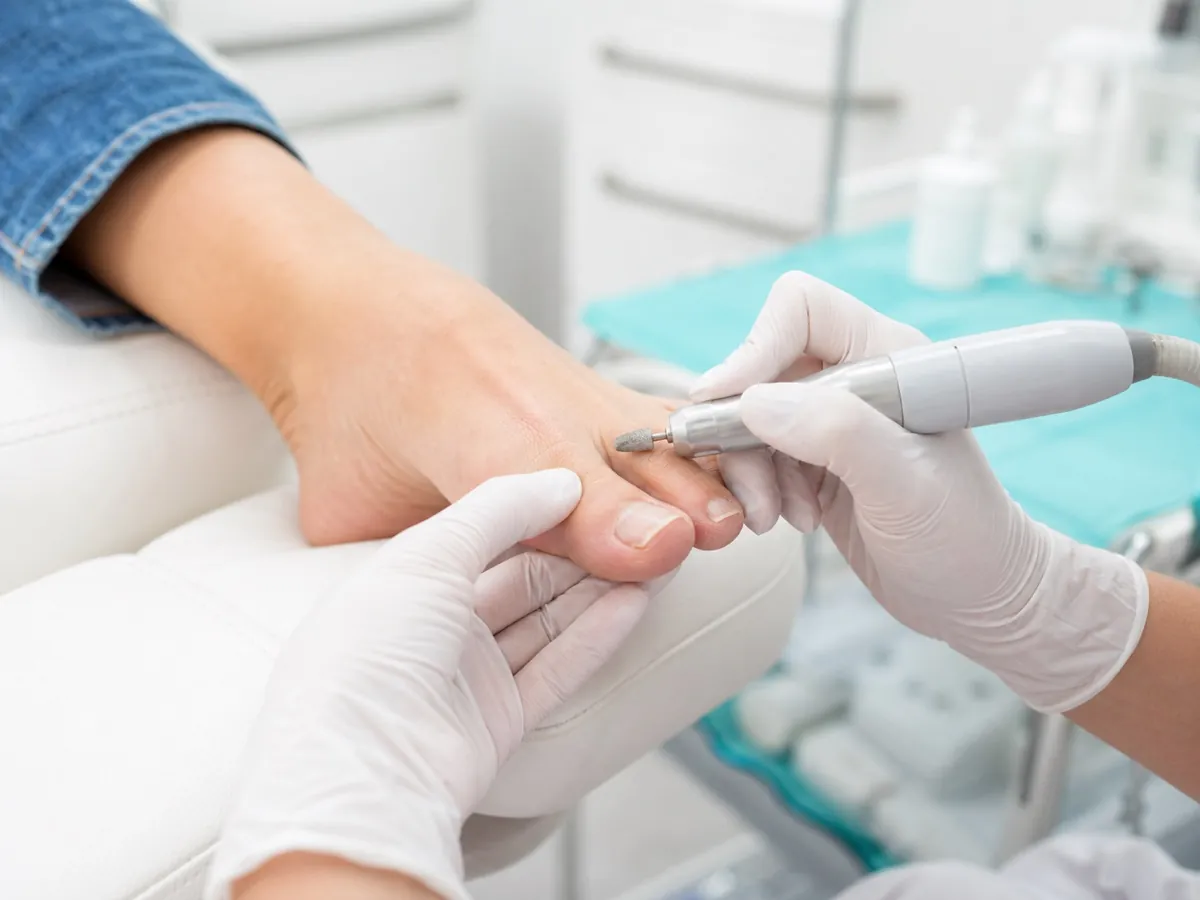 Corte y fresado profesional de uñas en consulta podológica